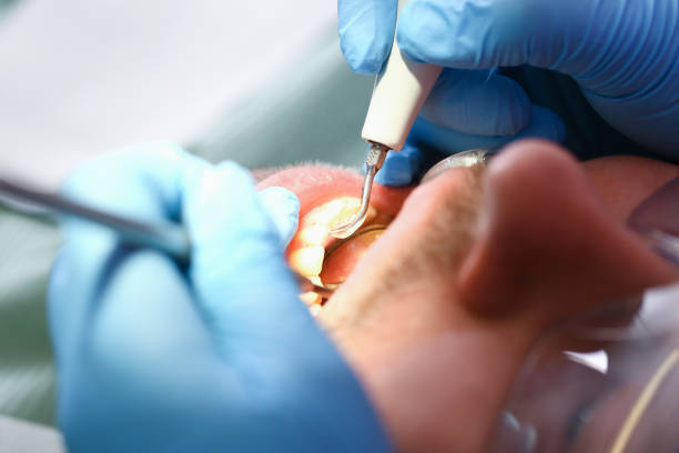 Best Walk-In Emergency Dentist in Stratford, TX